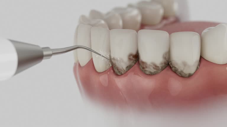 Reliable Emergency Dentist contractor in Markham, IL by Smile Center Dentistry